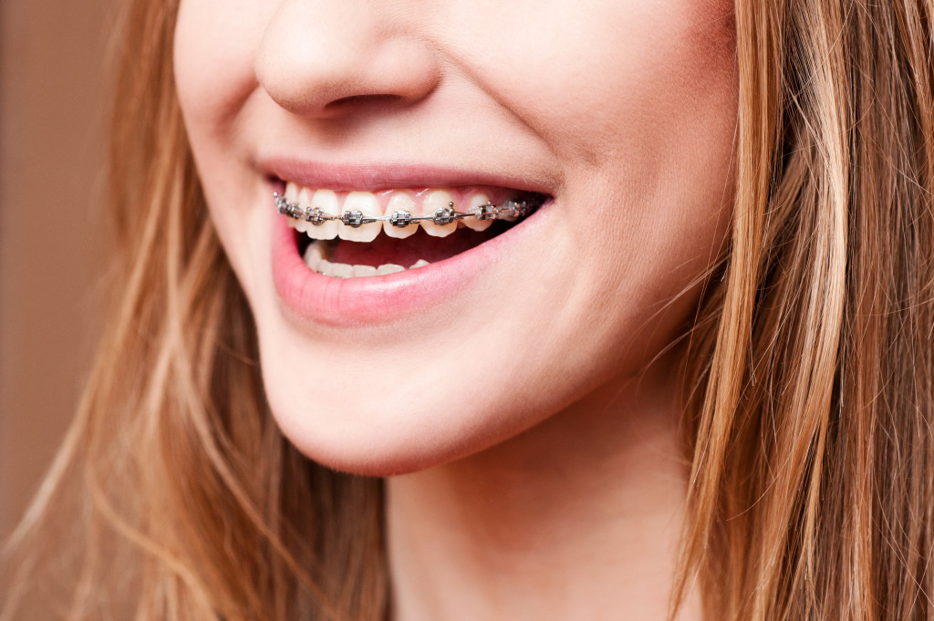 Portrait of a young woman showing her braces with a smile 
